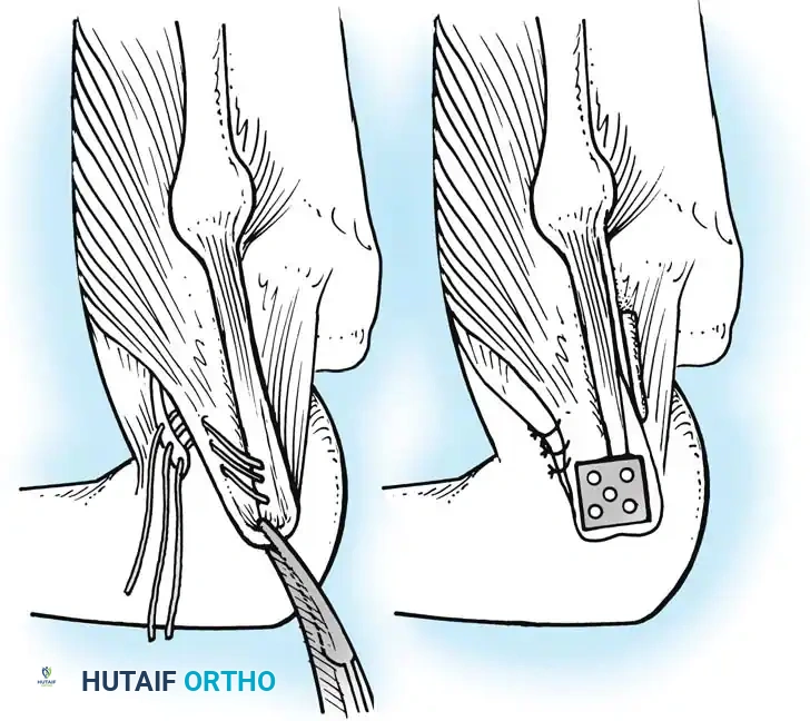 Hutaifortho's Orthopaedic Diagram