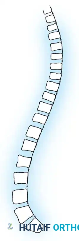 Adult Idiopathic Scoliosis: Comprehensive Surgical Management Guide