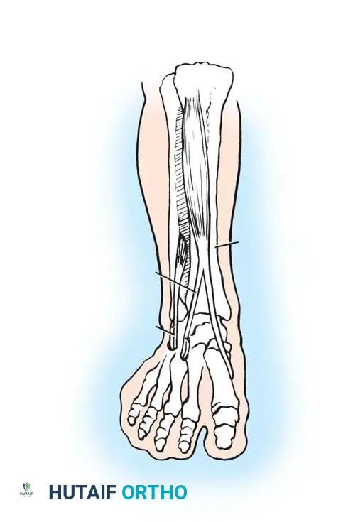 Advanced Orthopaedic Management of Adults with Cerebral Palsy and Post-Stroke Hemiparesis