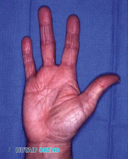 Hutaifortho's Orthopaedic Diagram