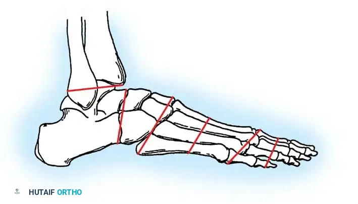 Levels of partial foot amputation
