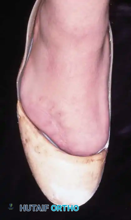 Hutaifortho's Orthopaedic Diagram