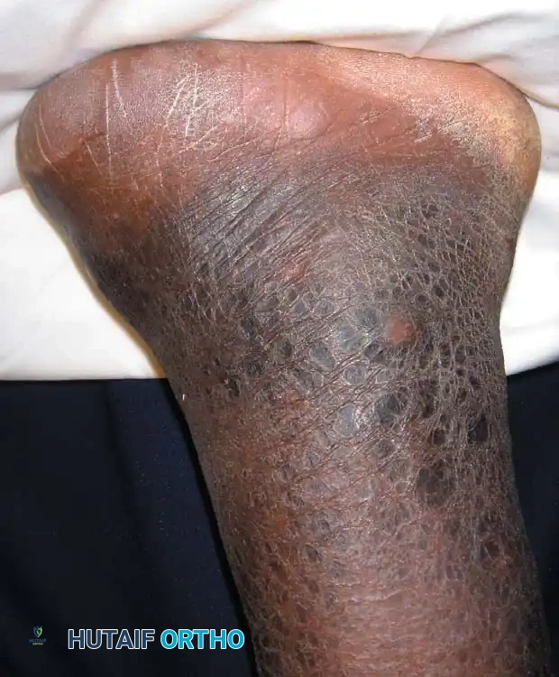 Surgical diagram A/B