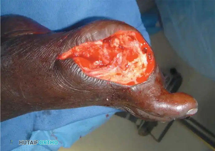 Hutaifortho's Orthopaedic Diagram