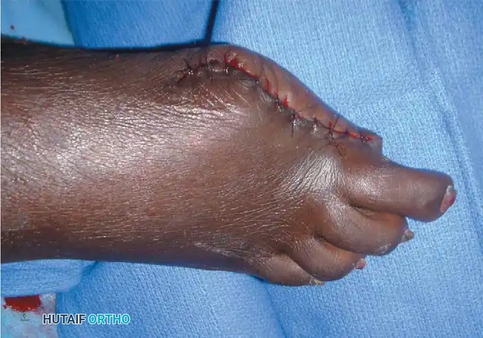 Hutaifortho's Orthopaedic Diagram