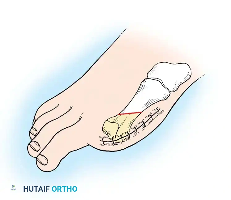 Hutaifortho's Orthopaedic Diagram