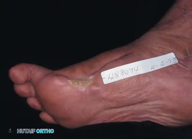 Hutaifortho's Orthopaedic Diagram