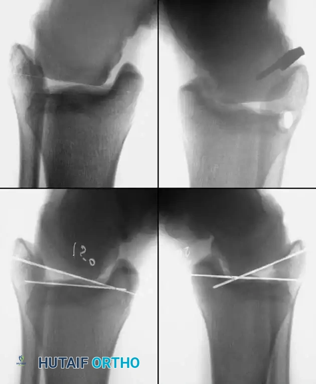 Hutaifortho's Orthopaedic Diagram