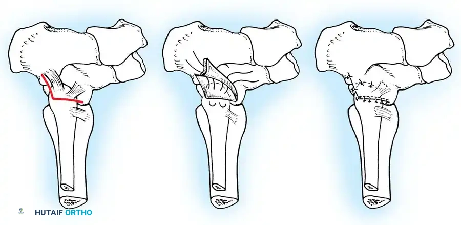 Hutaifortho's Orthopaedic Diagram