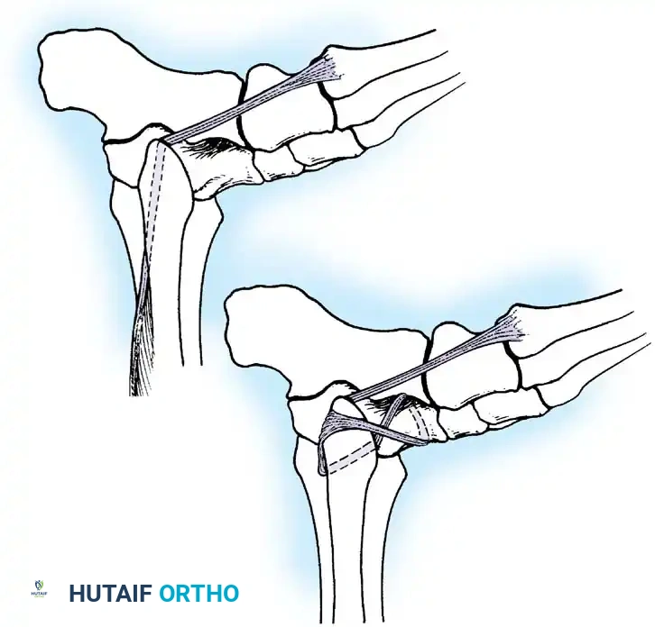 Hutaifortho's Orthopaedic Diagram