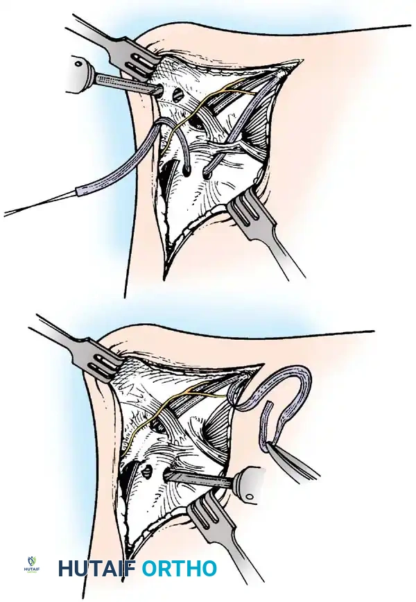 Hutaifortho's Orthopaedic Diagram