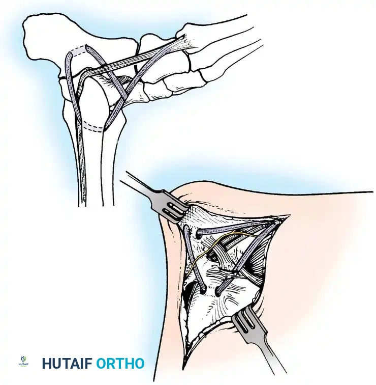 Hutaifortho's Orthopaedic Diagram