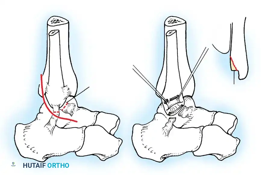 Hutaifortho's Orthopaedic Diagram