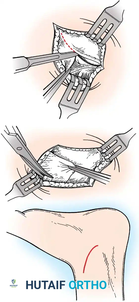 Hutaifortho's Orthopaedic Diagram