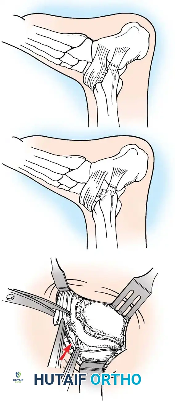Hutaifortho's Orthopaedic Diagram