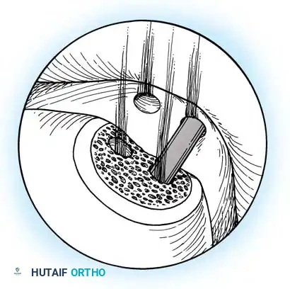 Hutaifortho's Orthopaedic Diagram