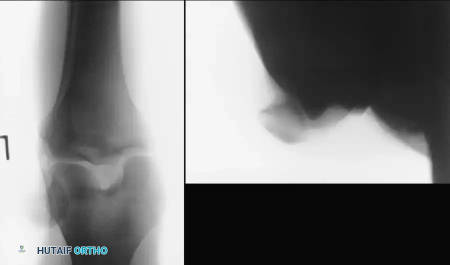 Operative Management of Patellar, Knee & Ankle Dislocations