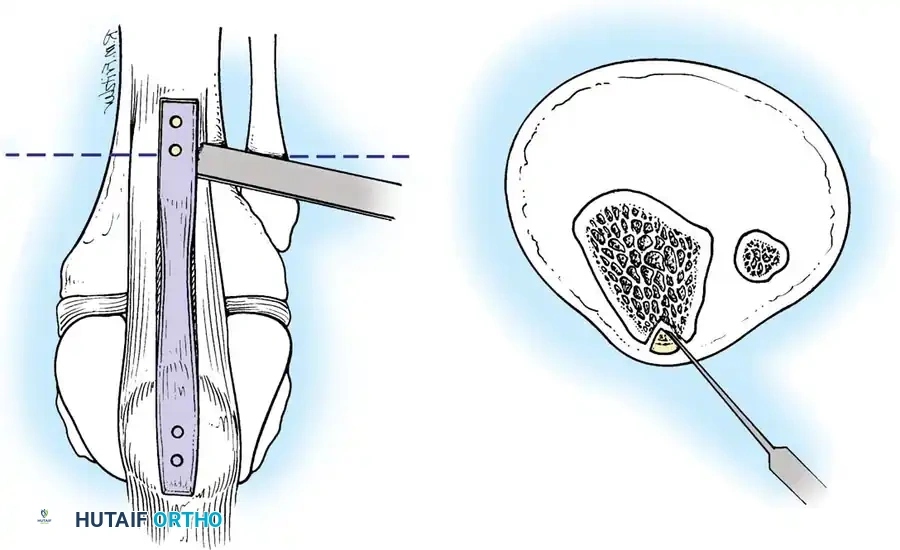 Hutaifortho's Orthopaedic Diagram