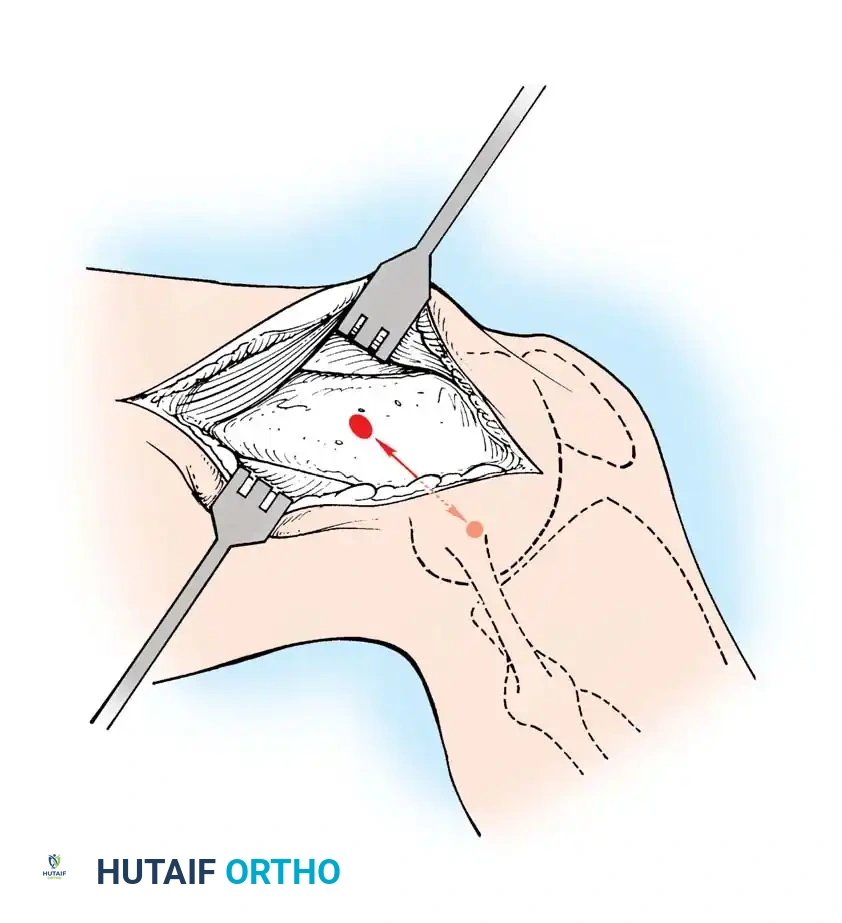 Hutaifortho's Orthopaedic Diagram