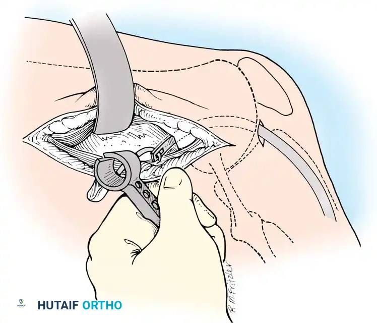 Hutaifortho's Orthopaedic Diagram