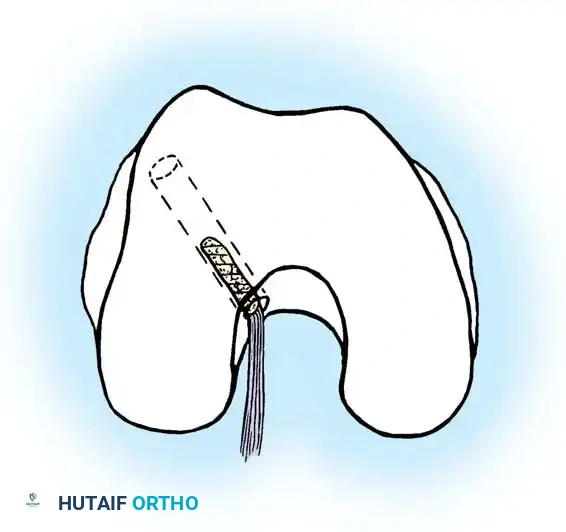 Hutaifortho's Orthopaedic Diagram
