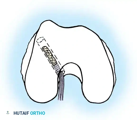 Hutaifortho's Orthopaedic Diagram