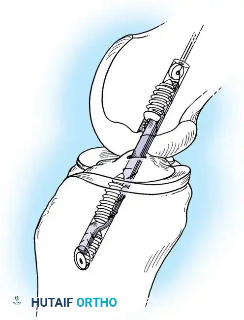 Hutaifortho's Orthopaedic Diagram