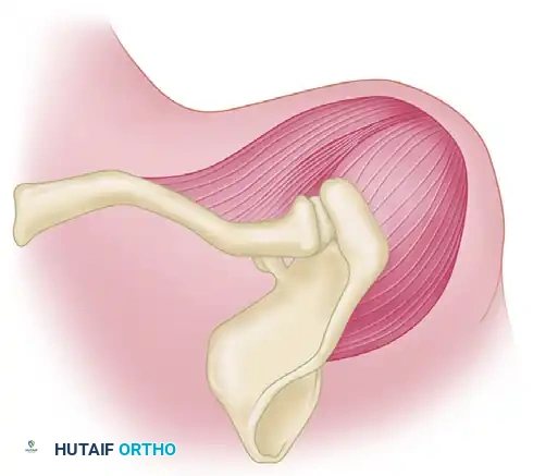 Open Reduction of Anterior Shoulder Dislocations: Surgical Techniques and Protocols