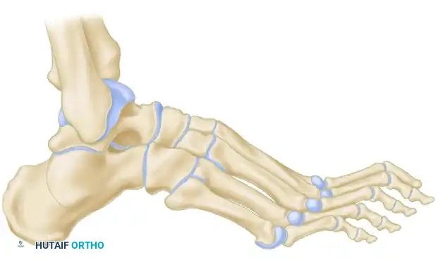 Samilson Osteotomy Diagram B