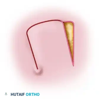 Orthopaedic Skin Grafting and Local Flap Reconstruction