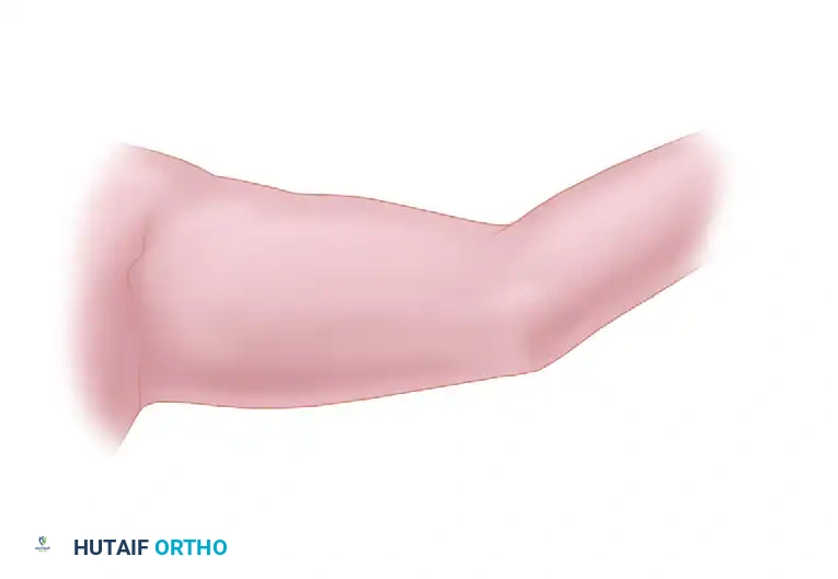 Hutaifortho's Orthopaedic Diagram