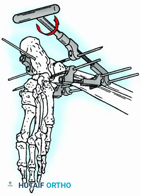 Hutaifortho's Orthopaedic Diagram