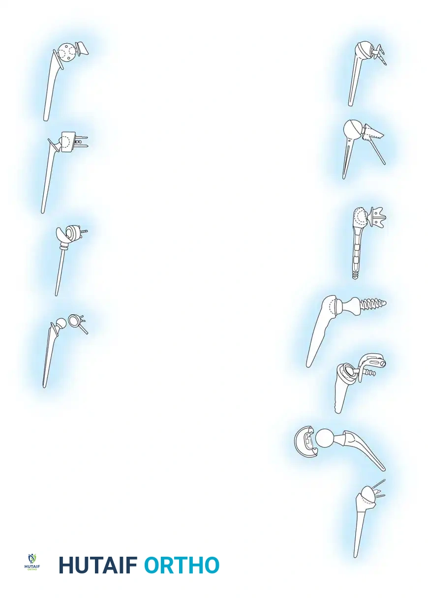 Arthroplasty of the Shoulder and Elbow Surgical Diagram