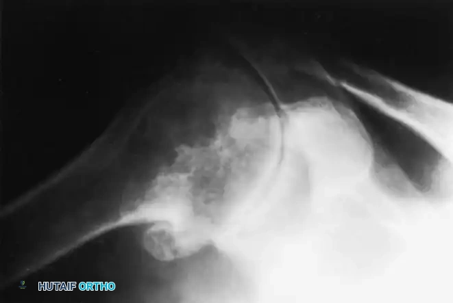 Hutaifortho's Orthopaedic Diagram