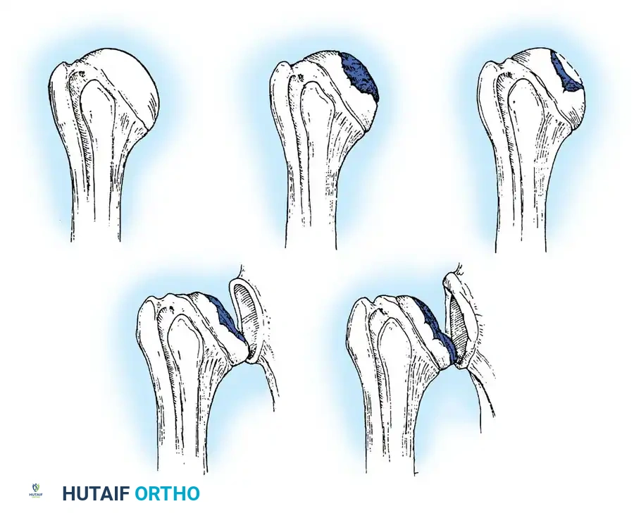 Hutaifortho's Orthopaedic Diagram