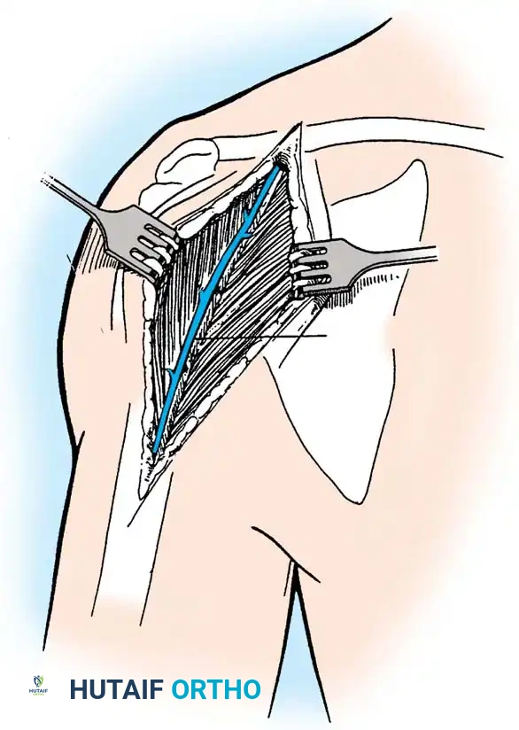 Hutaifortho's Orthopaedic Diagram