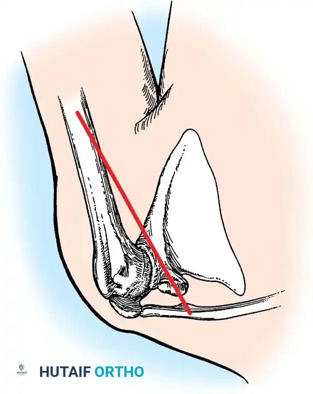 Hutaifortho's Orthopaedic Diagram
