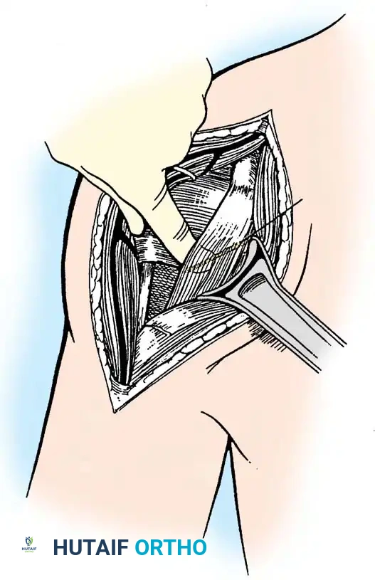 Hutaifortho's Orthopaedic Diagram