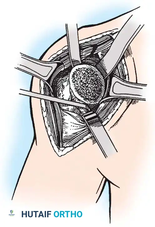 Hutaifortho's Orthopaedic Diagram