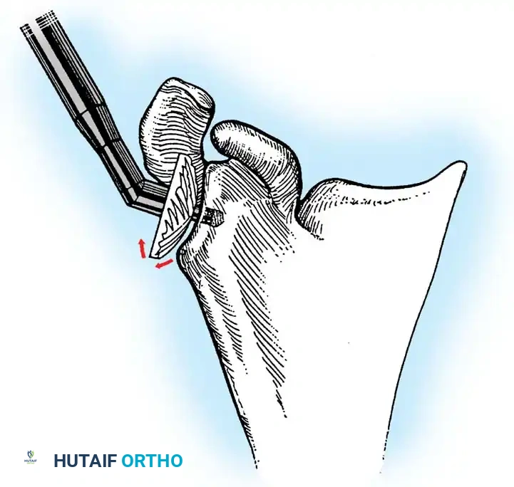 Hutaifortho's Orthopaedic Diagram