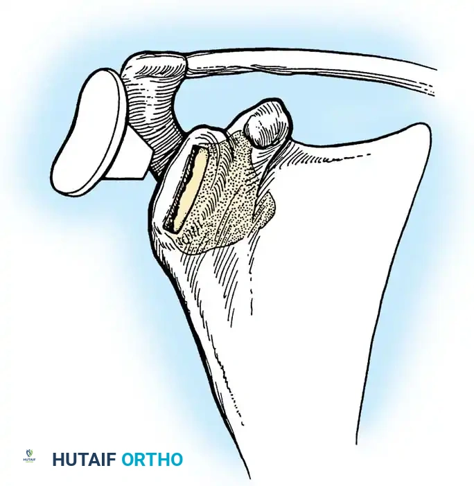 Hutaifortho's Orthopaedic Diagram