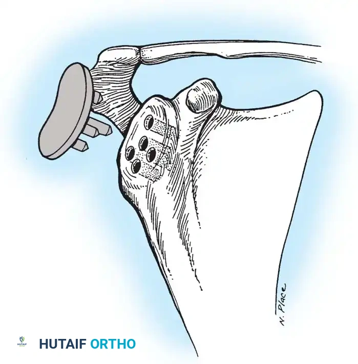 Hutaifortho's Orthopaedic Diagram