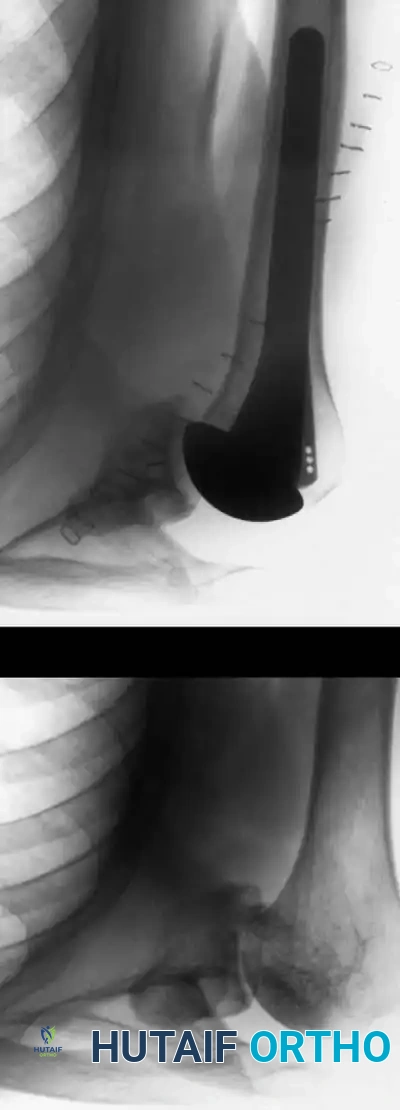 Hutaifortho's Orthopaedic Diagram