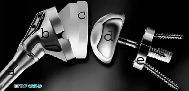 Hutaifortho's Orthopaedic Diagram