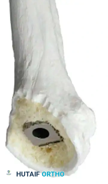 Hutaifortho's Orthopaedic Diagram