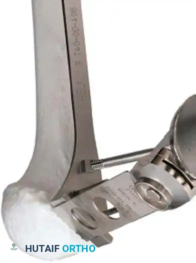 Hutaifortho's Orthopaedic Diagram