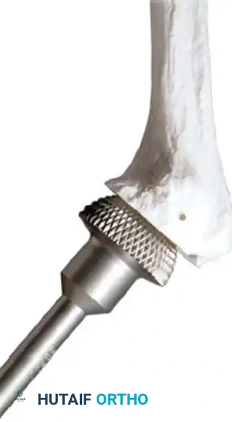 Hutaifortho's Orthopaedic Diagram