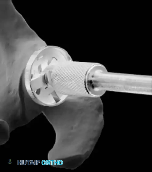 Hutaifortho's Orthopaedic Diagram