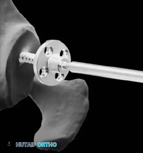 Hutaifortho's Orthopaedic Diagram