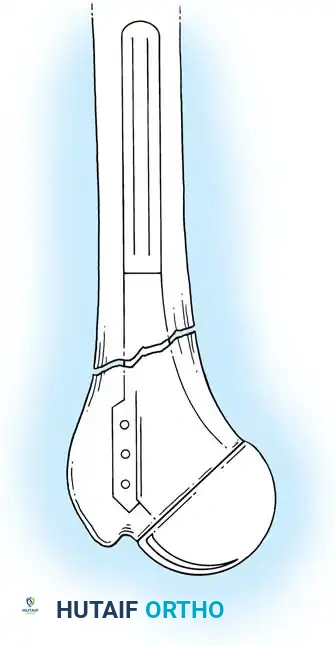 Hutaifortho's Orthopaedic Diagram